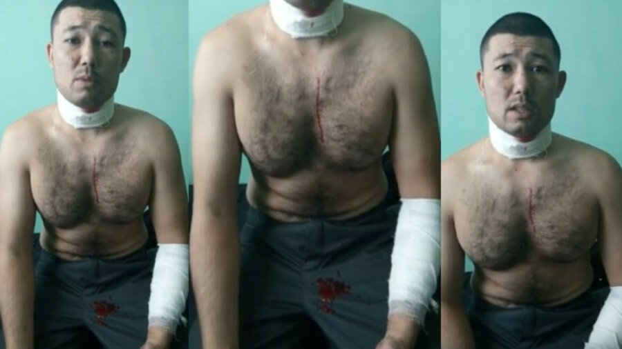 Видео с окровавленным осужденным из колонии ЛА-155/12 в Заречном появилось в сети 