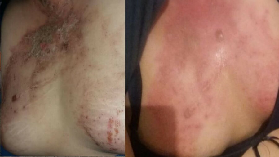 «Оторвал ей сосок на груди, пинал и надругался»: в шокирующем скандале замешаны полиция и врачи Алматы 
